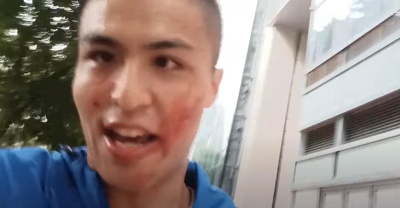 網媒記者荃灣疑遭「網紅」劉馬車施襲